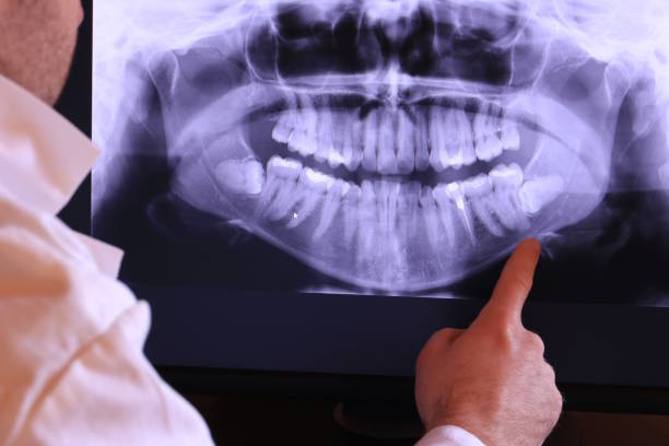Best Emergency Dental Surgery in Manson, WA