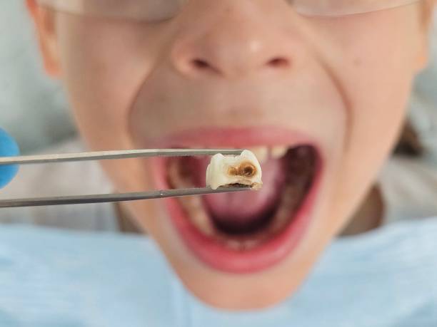 Best Emergency Dental Surgery in Manson, WA